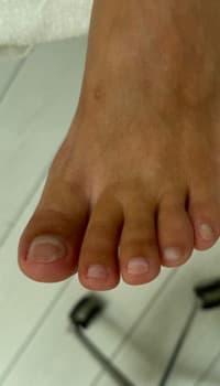 Gezonde nagels na 7 maanden tiptoe behandeling
